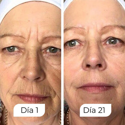 Suscripción Rejuven