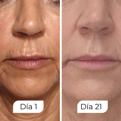 Suscripción Rejuven