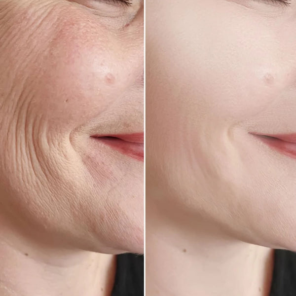 Glowskin Pro® - Máscara LED Antiedad