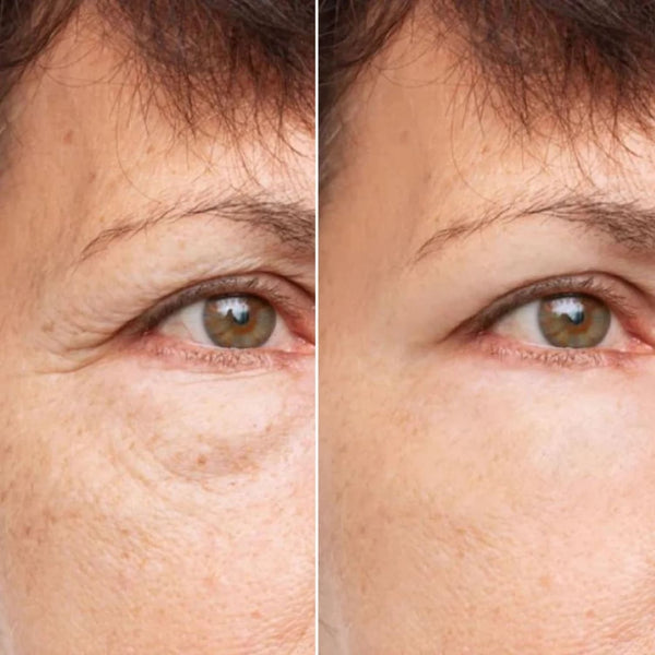 Glowskin Pro® - Máscara LED Antiedad
